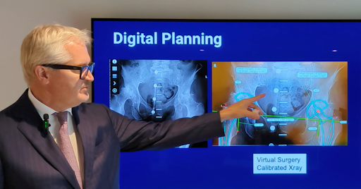 Digital planning - Computer Alignment for Hip Replacements