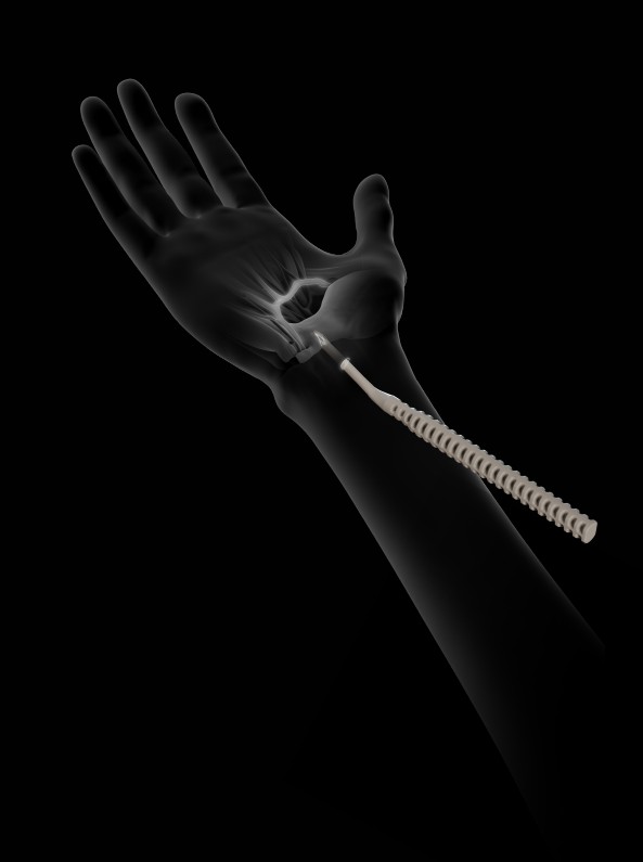 ACL repair and reconstruction surgery London