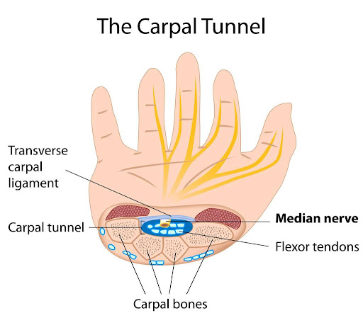 high risk occupations for carpal tunnel syndrome - Orthopaedic Innovations