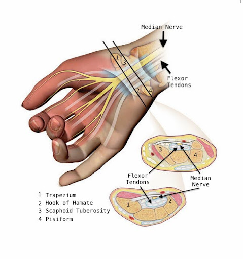 hand anatomy - carpal tunnel night pain