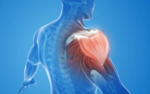 Rotator Cuff Surgery Success Rates