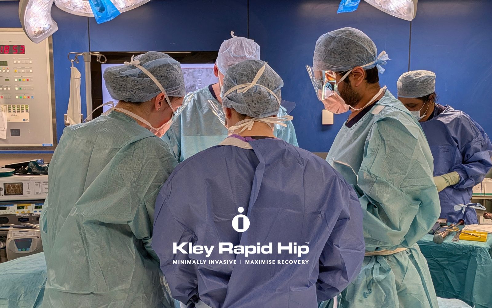 High BMI and Hip Replacement: What the Hip-Specific Evidence Actually Shows