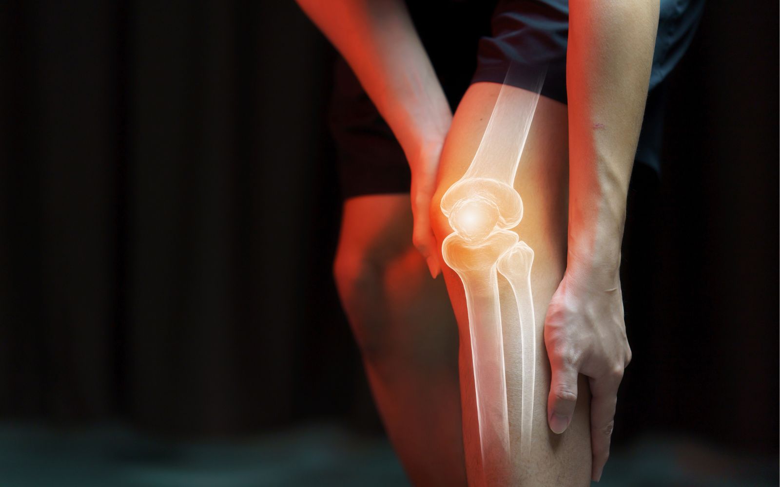 How Do I Know When I Need a Knee Replacement? The 4 Signs to Watch For
